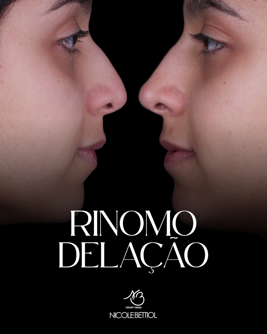 Caso clínico: Rinomodelação